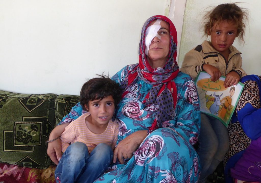 Injured woman at refugee camp in Kobane