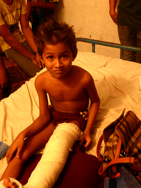 The boy who survived his house being burned and part of the roof falling on his leg.