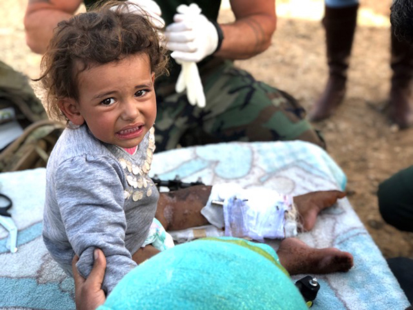 A little girl injured by IED.