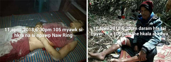 Left: Npawp Naw Ring who was killed by a 105mm shell. Right: Npyaw Yaw Han who was Injured by a fragment of the 105mm shell. Both photos provided by Kachin Independence Army.