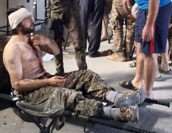 A wounded soldier in the field hospital.