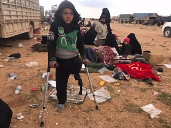 One of the many maimed children at the collection site.