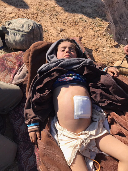 Above and below: some of the wounded who have fled the last ISIS stronghold.