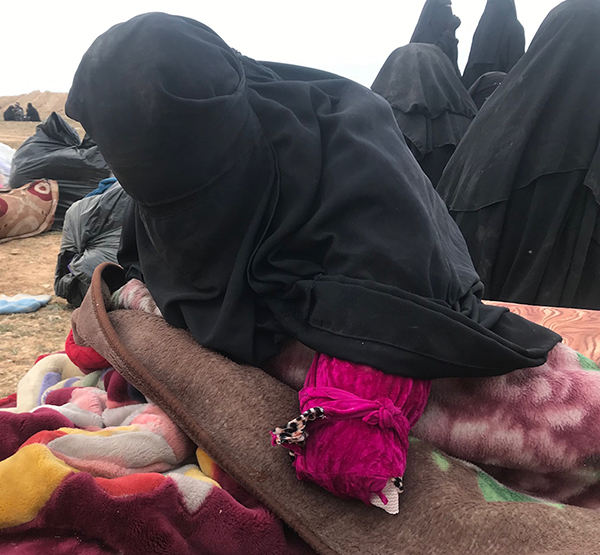 A woman who lost her arm waits for treatment.