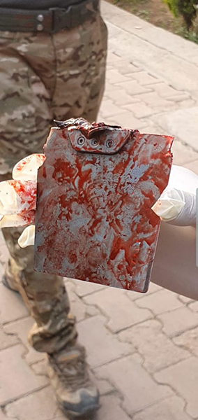 Part of a Turkish drone munition removed from a victim.