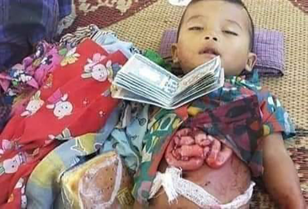 A child from Wohmah Village killed when Burma Army jets bombed the village on March 17.