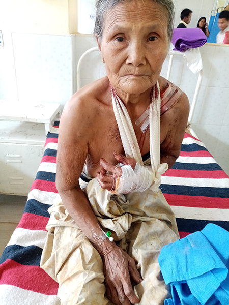 A woman injured in the Burma Army bombing of Wohmah Village on March 17.
