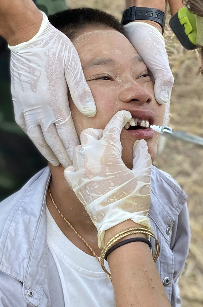 Village child receiving dental care