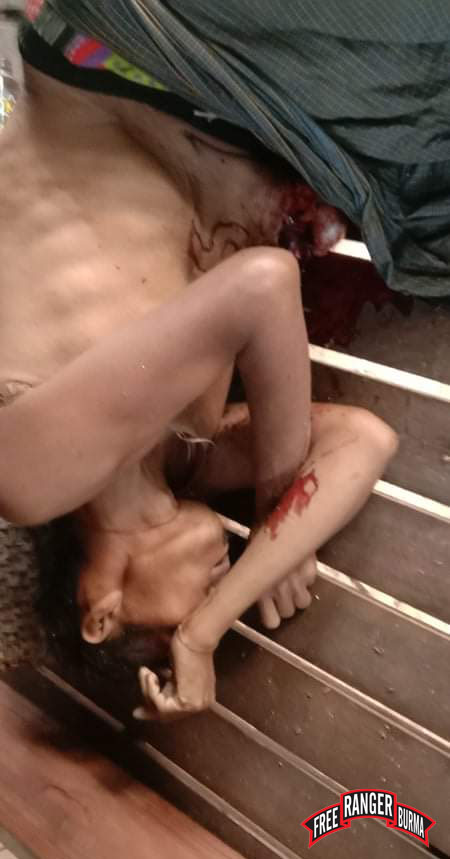 Saw Pah Lo Poe, killed by Burma Army airstrike 2